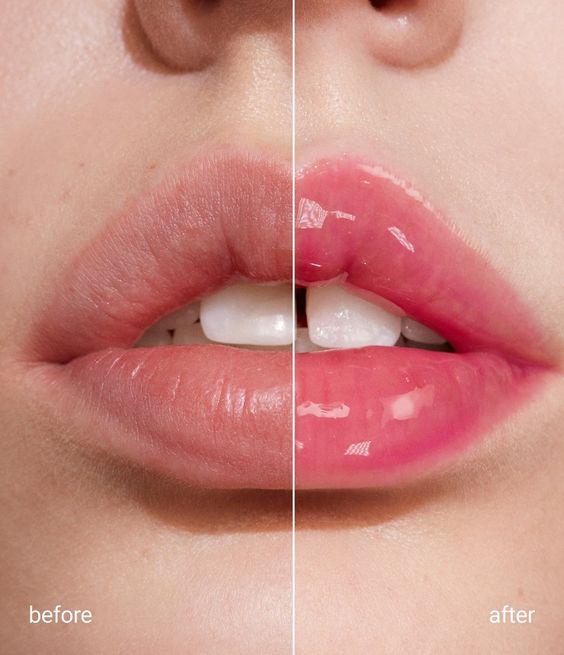 Lip Oils vs. Lip Balms: Why Lip Oils are the Superior Choice for Your Lips